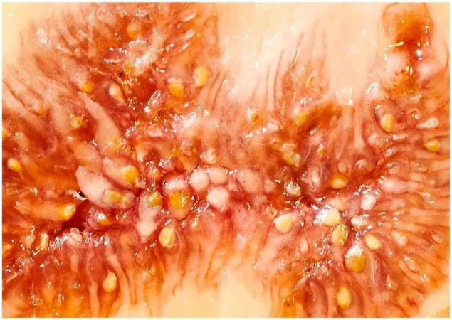 Extreme close-up of a fig fruit interior reveals a multitude of seeds and pulp, showcasing the fruit's texture and color.