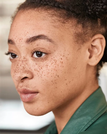 Close-up portrait of a Black woman with heavy freckles wearing a green collar, photographed by Tom Corbett in New York.