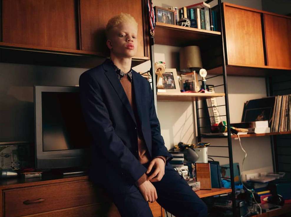Stylish young adult with albinism, wearing a suit in a room, posing against wooden cabinets and shelves with records and books.
