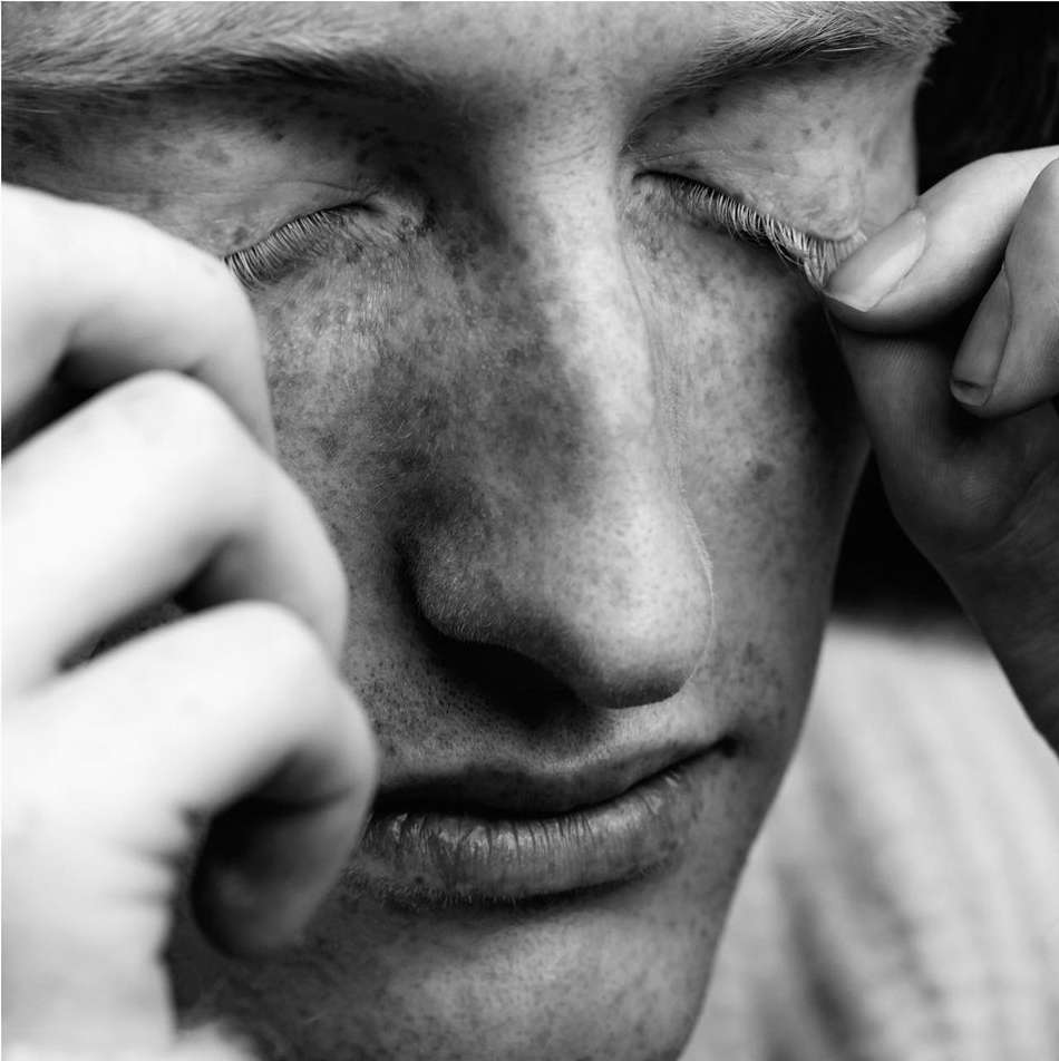 Close-up in black and white of a young adult male with freckles holding his eyelids open to expose false eyelashes.