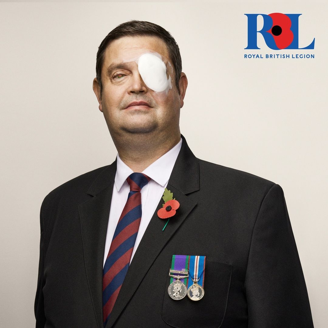 Portrait of an adult male wearing a suit, tie, and service medals with a bandage over his eye, standing against a neutral background.