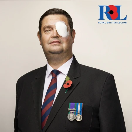 Portrait of an adult male wearing a suit, tie, and service medals with a bandage over his eye, standing against a neutral background.