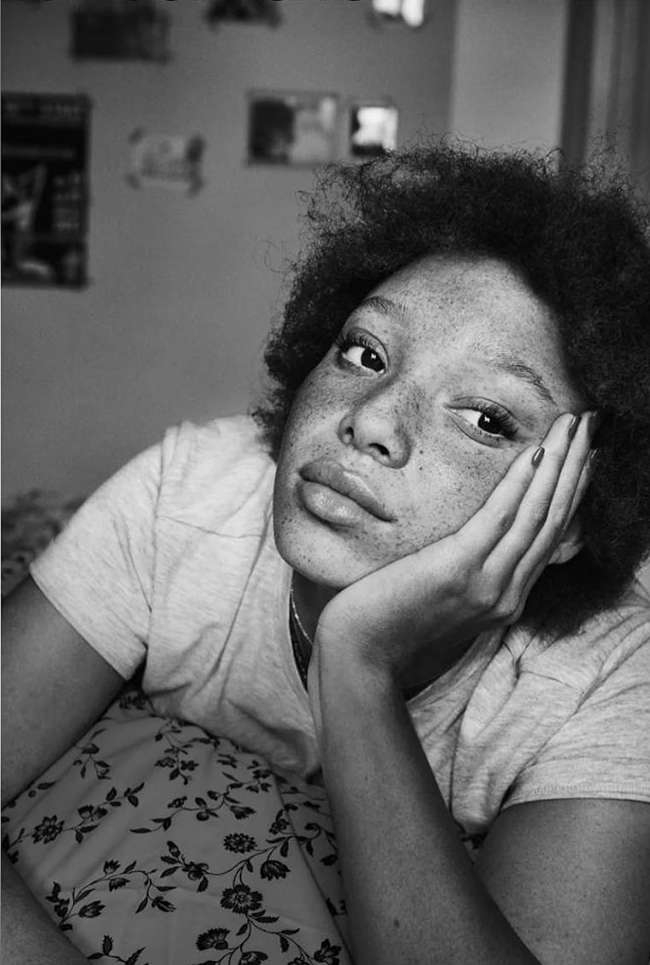 Black and white portrait of a woman with freckles resting her face on her hand, lying on a floral pillow in an indoor setting.