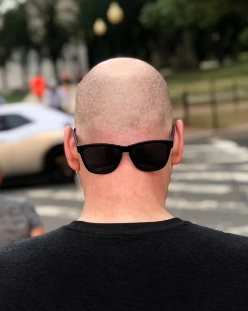 From behind, a bald man with sunglasses is walking down a crosswalk outdoors, with buildings and blurred cars in the background.