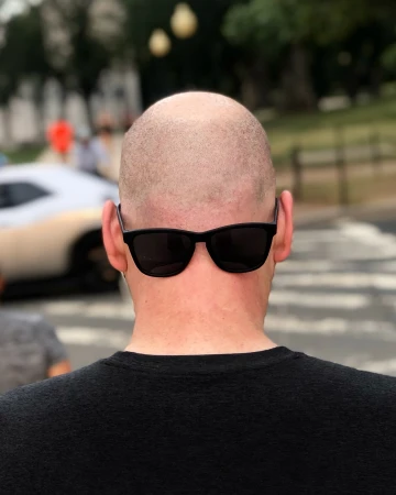 From behind, a bald man with sunglasses is walking down a crosswalk outdoors, with buildings and blurred cars in the background.