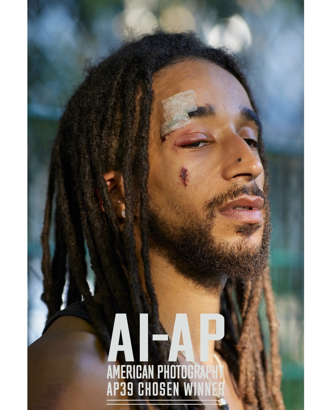 Close-up portrait of an adult male with dreadlocks and a bandage near his injured eye, set against a blurred green backdrop.