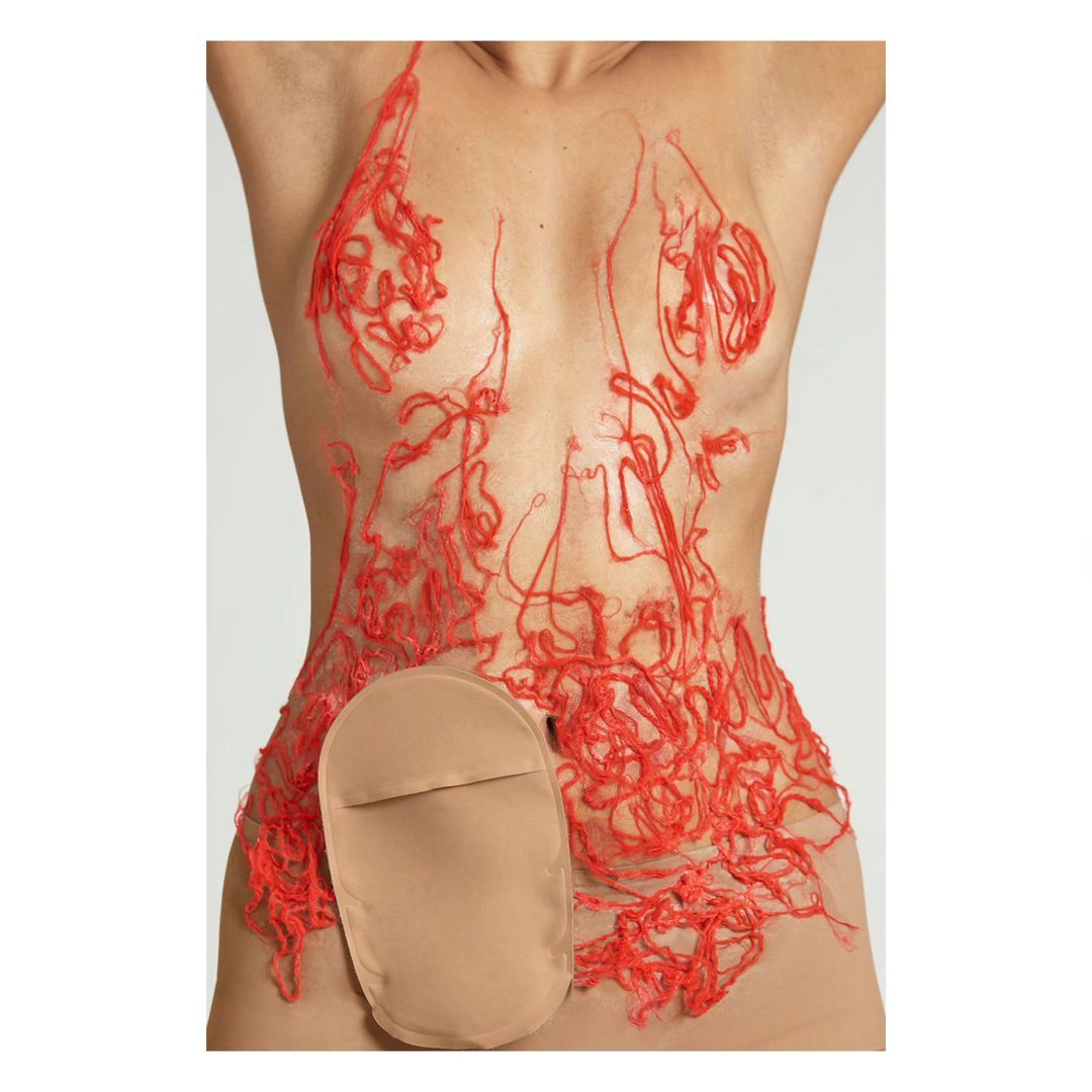 Adult torso with a tan ostomy bag adhered on the side of the abdomen. Red fiber is attached to the skin around the chest and abdomen.