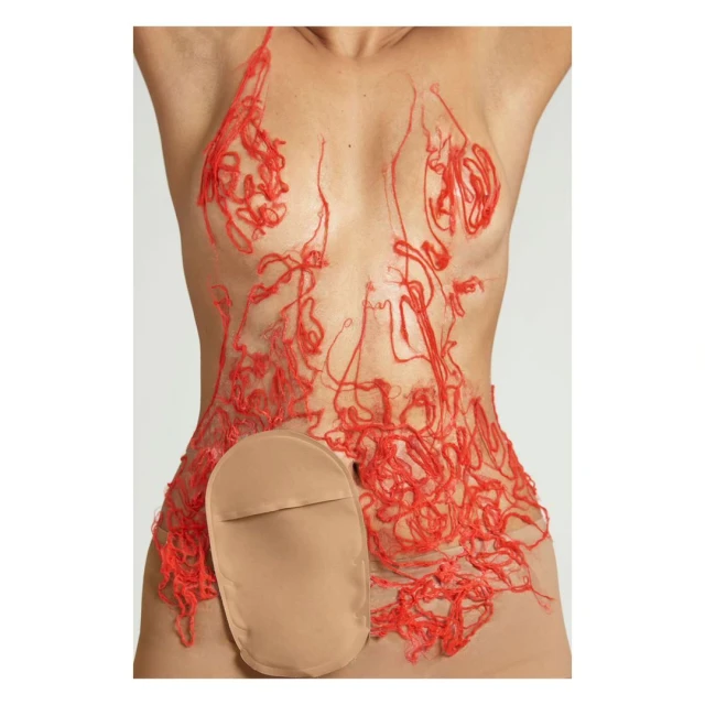 Adult torso with a tan ostomy bag adhered on the side of the abdomen. Red fiber is attached to the skin around the chest and abdomen.