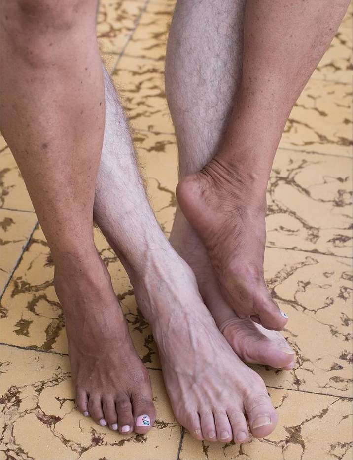 Close-up of two people's legs and feet, one fair-skinned and one brown-skinned, standing on a tile floor, showcasing diversity.