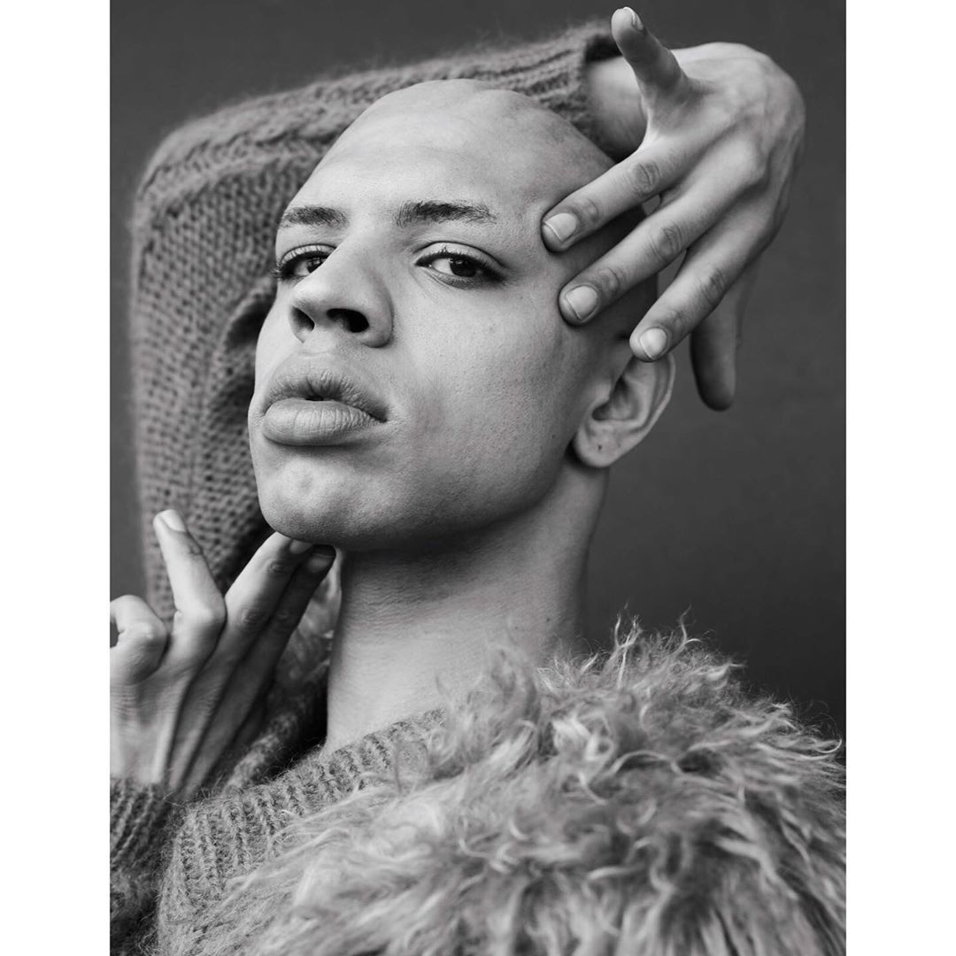 Striking black and white portrait of a bald adult with hands framing face, wearing sweater with fur-like collar against dark backdrop.