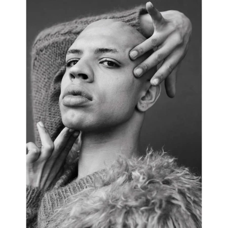 Striking black and white portrait of a bald adult with hands framing face, wearing sweater with fur-like collar against dark backdrop.
