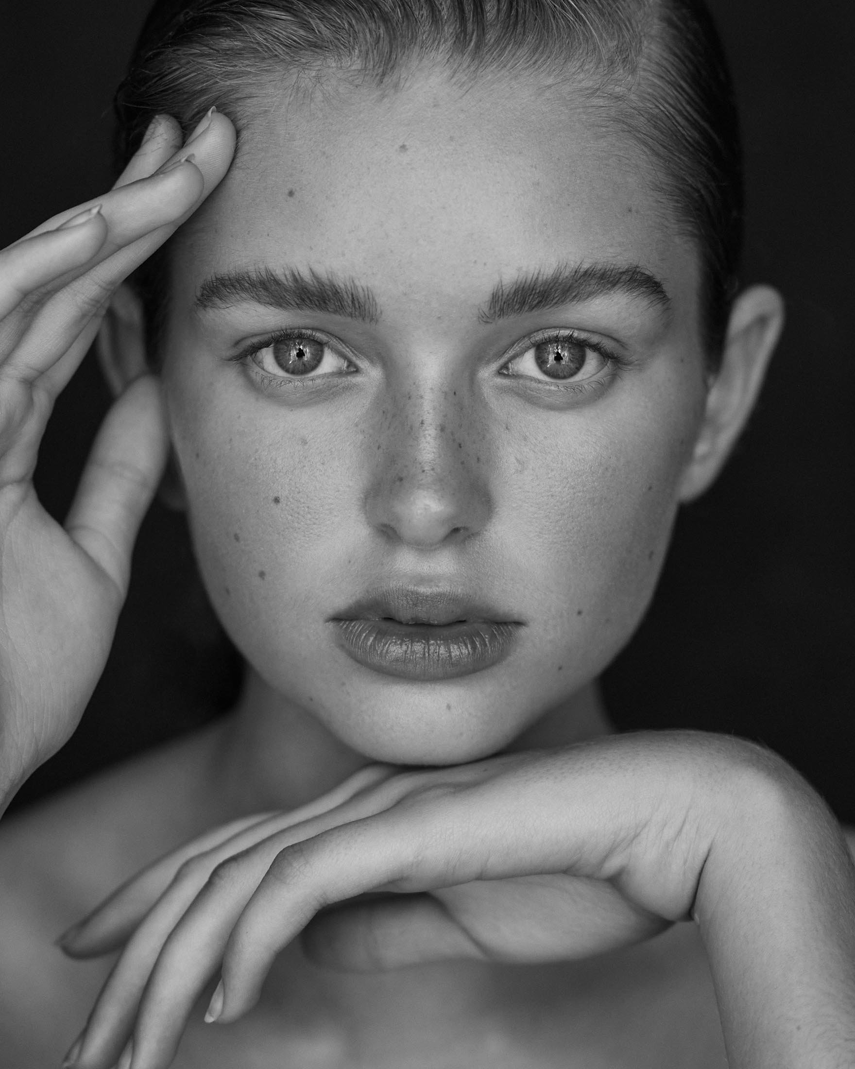 Close-up portrait of a woman with freckles resting her hands near her face against a dark background