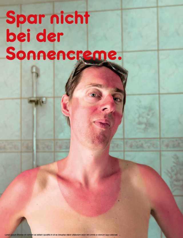 Man with severe sunburn on his face and chest stands in a bathroom with shower tiles, conveying a health or skin safety advertisement.