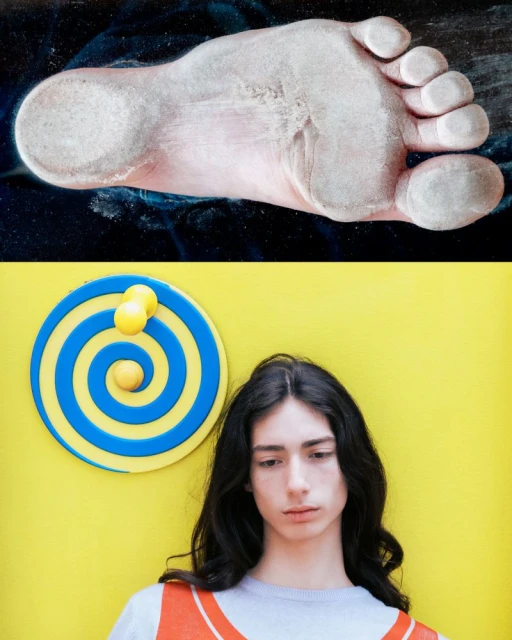 Conceptual image featuring a foot with peeling skin above a young person with long hair, set against a yellow background.
