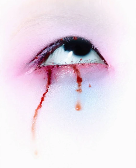 Close-up studio shot of a human eye with blood running from the eye, pink-purple toned skin, white background, dramatic lighting.