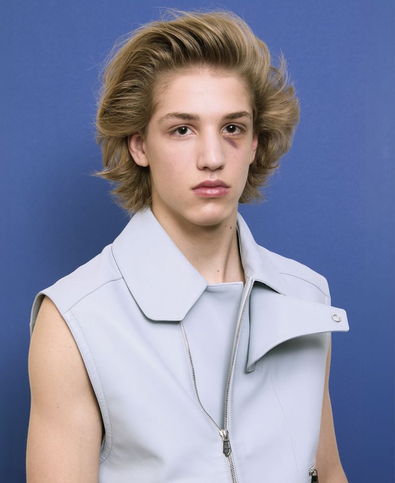 Portrait of a young adult male with a black eye, blonde hair, wearing a light blue vest against a blue backdrop. Studio lighting.