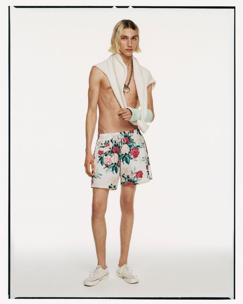 A young adult male stands in a white photo studio wearing floral shorts, a sweater around his neck, and a cast on his left arm.