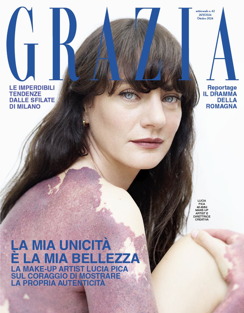 Grazia magazine cover featuring a woman with dark hair and light eyes, distinctive skin condition, posing with text overlay in blue and white.