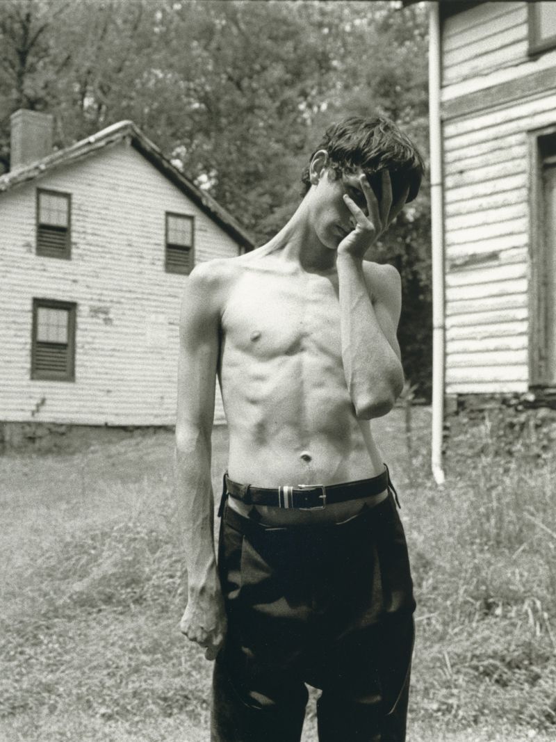 Black and white portrait of a slender, shirtless young man covering his face with his hand in a grassy, rural yard.