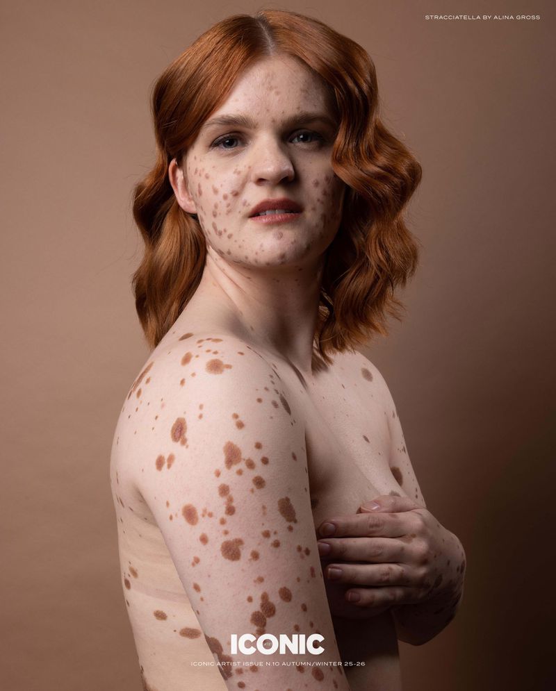 Portrait of a red-haired woman with skin pigmentation holding her arm across her chest against a tan and brown gradient backdrop.