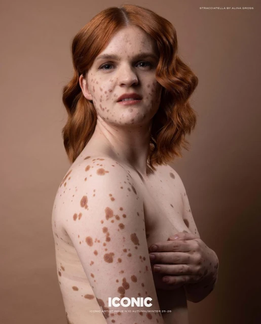 Portrait of a red-haired woman with skin pigmentation holding her arm across her chest against a tan and brown gradient backdrop.