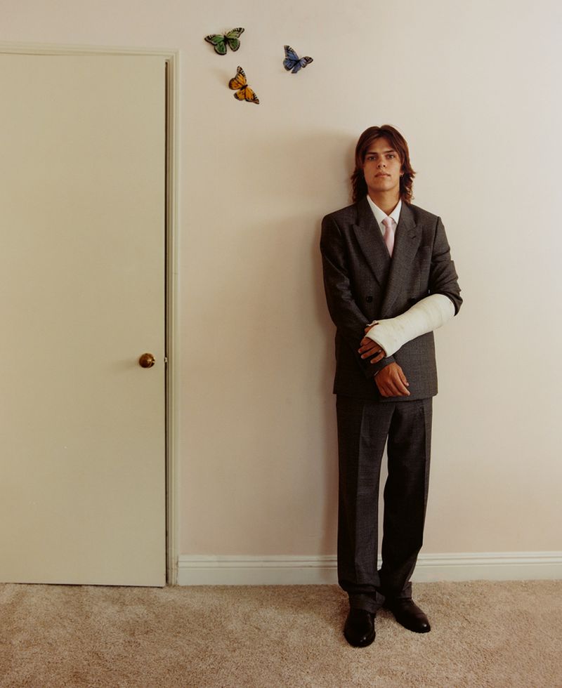 Young man in a grey suit with a cast on his arm stands indoors against a wall, butterflies on the wall, carpet on the floor.