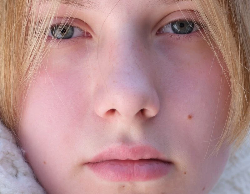 Close-up portrait of a fair-skinned young adult with light blonde hair and grey eyes, focusing on facial features and skin details.