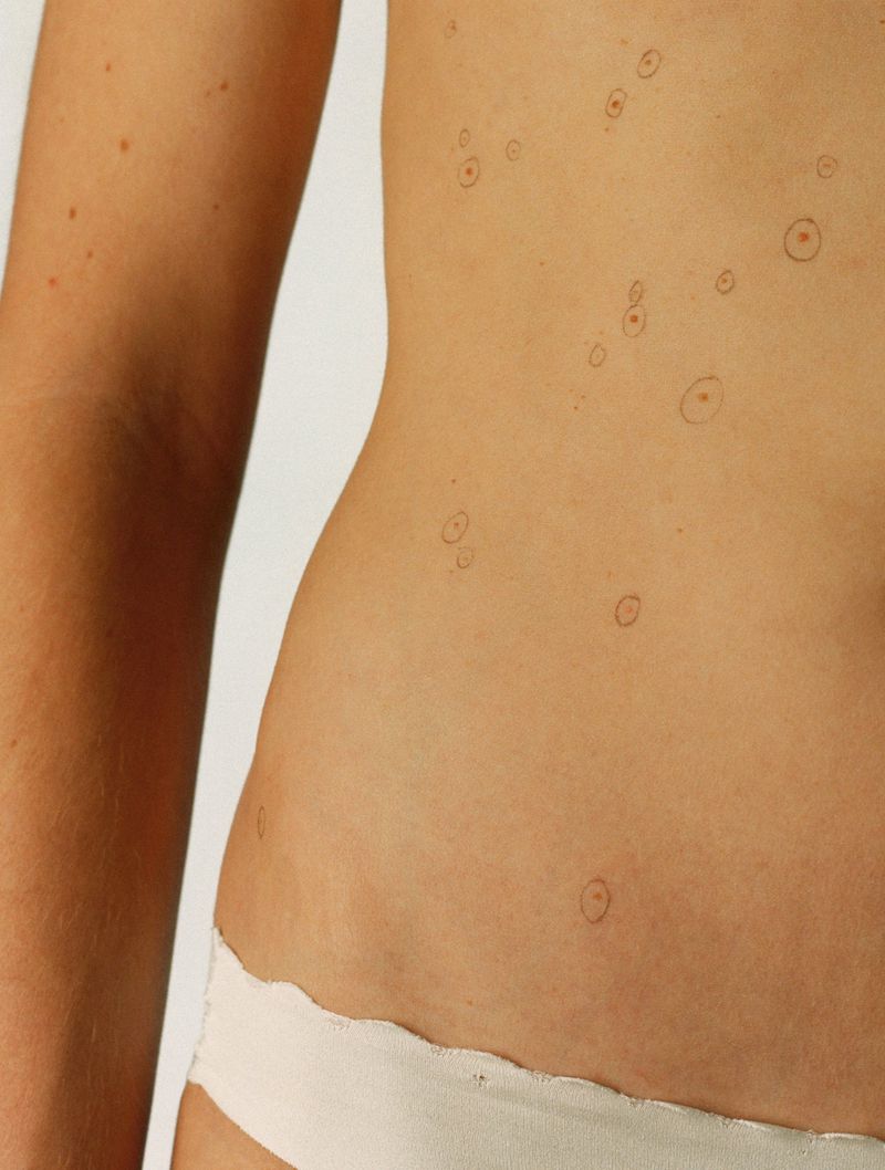 Close-up portrait focusing on a person's torso marked with small hand-drawn circles around spots against a plain background.