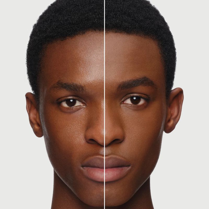 Split-screen portrait of a dark-skinned adult male showcasing contrasting skin tones on each side, presented against a neutral backdrop.