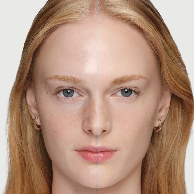 Close-up of a light-skinned woman's face, showcasing two sides: one with blemishes and the other with a flawless, airbrushed look.