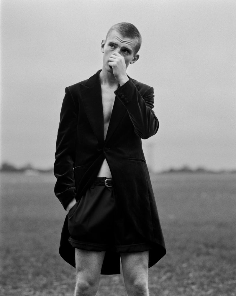 Black and white portrait of a young man in an open blazer standing in a field under a cloudy sky, looking upwards, hand near face.