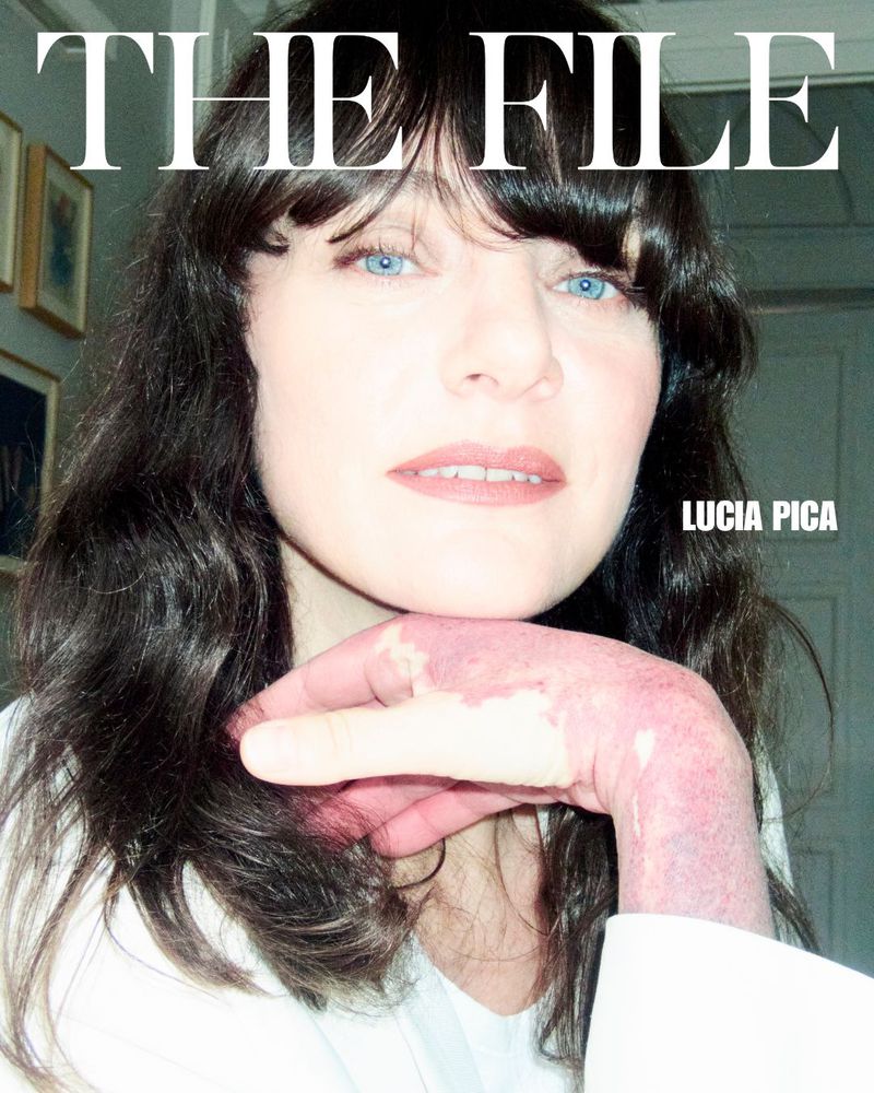 Close-up studio portrait of an adult female with blue eyes and dark hair, featuring a hand with skin discoloration, and neutral tones.