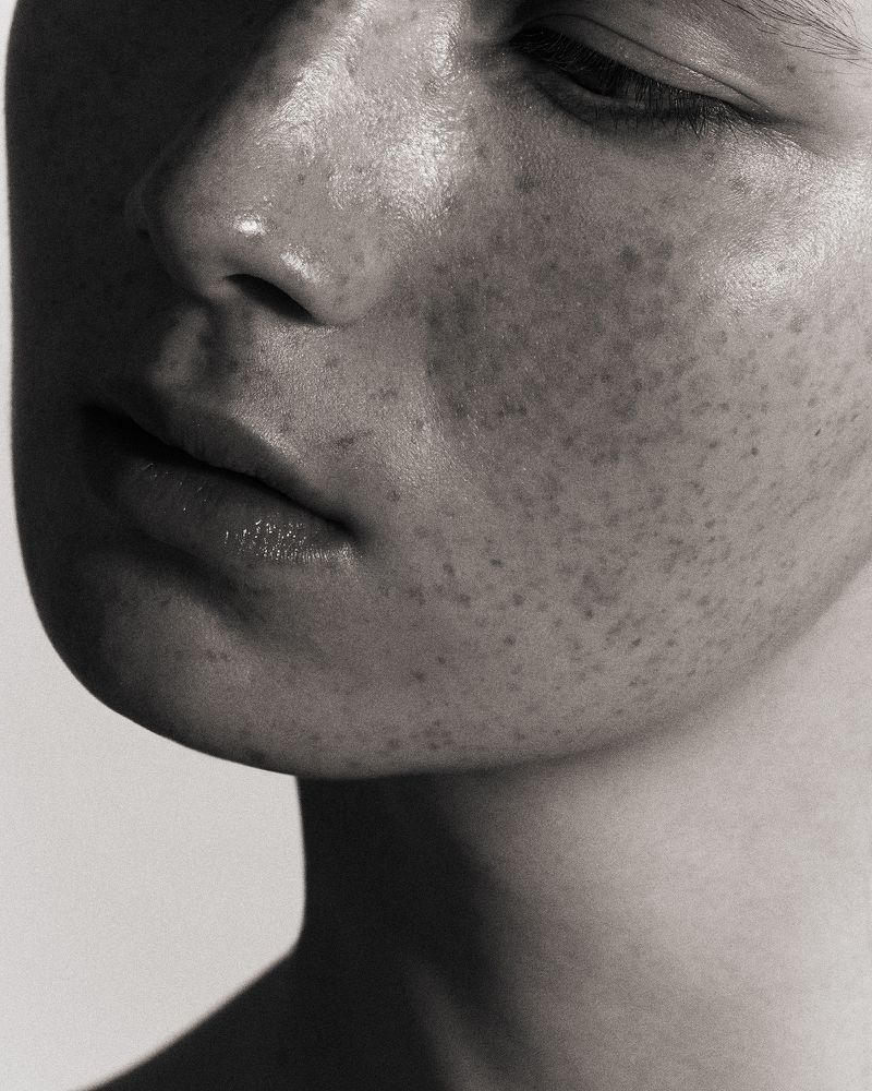 Close-up portrait of a young adult woman with fair skin, freckles, and subtle makeup, shot in black and white with diffused lighting.