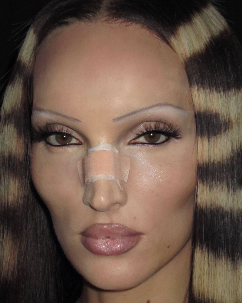Close-up of a woman's face with tan skin, brown hair with lighter stripes, and a bandage on her nose, set against a dark backdrop.