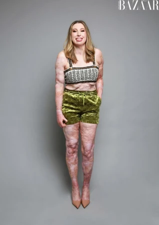Improving representation and Inclusion in fashion