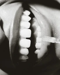 Close-up macro shot of lips parted showing teeth while a lip gloss applicator applies product