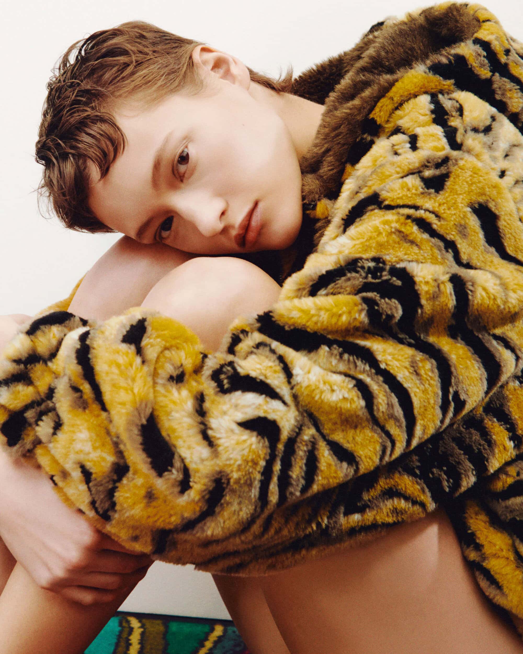 Close-up portrait of a young adult female resting with arms around knees, wearing a fuzzy yellow-and-black striped jacket against a white background.