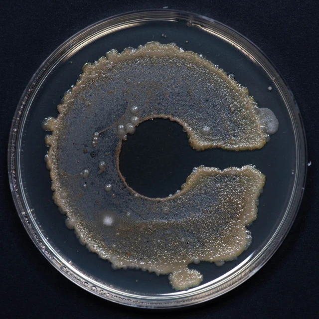 Petri dish displaying a culture forming the shape of a letter 'C', showcasing microbiology and laboratory science.