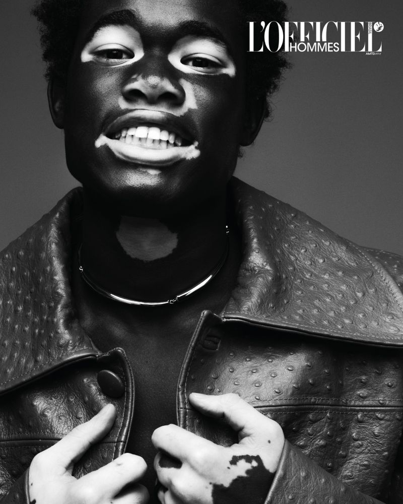 Black and white portrait of a man with vitiligo wearing a leather jacket and necklace, against a grey background, L'Officiel Hommes logo visible.