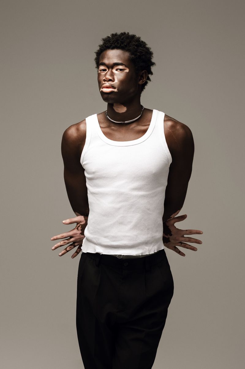 Portrait of a young Black male model with vitiligo wearing a white tank top and black pants posing in front of a grey background.