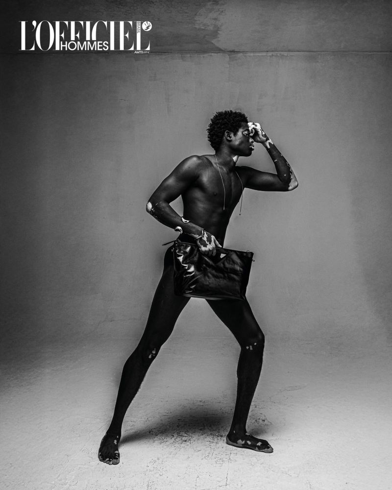 Fashionable man with vitiligo poses with a black leather pouch in a studio. Black and white fashion editorial for L'Officiel Hommes.