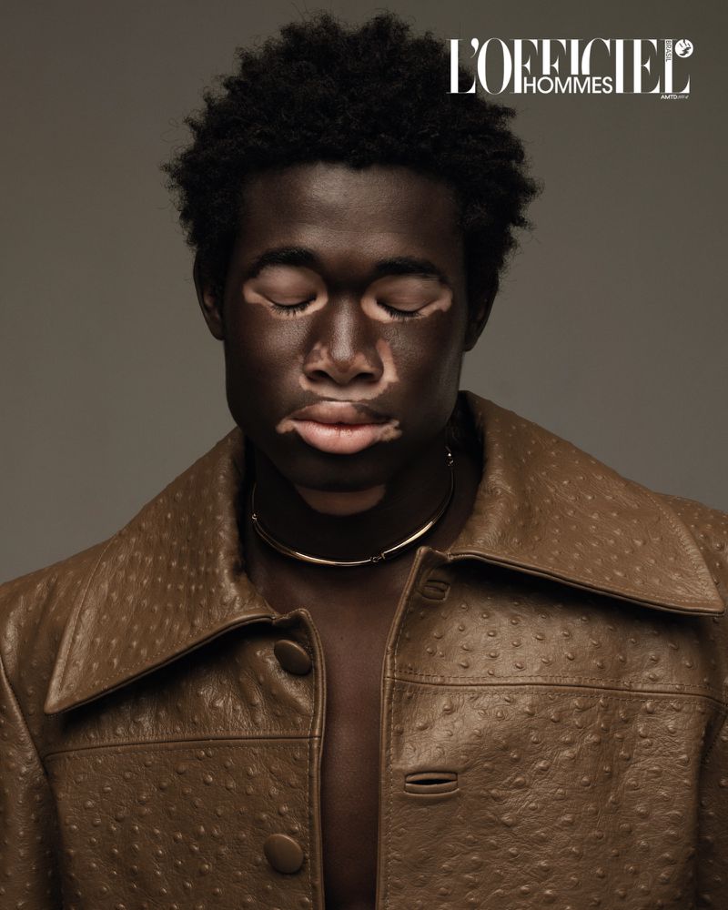 Portrait of a dark-skinned male model with vitiligo, wearing a brown leather jacket and a gold necklace against a gray backdrop.