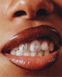 Close-up macro portrait of lips and teeth showing diamond-encrusted letter charms spelling ND against a grainy textured background