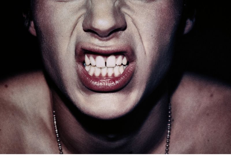 Close-up of an adult with gritted teeth and exposed gums, wearing a beaded necklace against a stark black background.