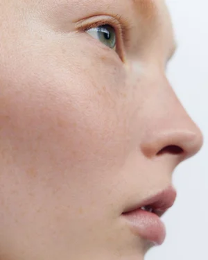 Close-up profile of a model's face highlighting natural skin texture, light freckles, green eyes, and soft makeup against a plain background.