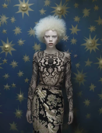 Albino female model in patterned bodysuit and skirt posing against a blue celestial backdrop with golden sun and star shapes. Fashion portrait.