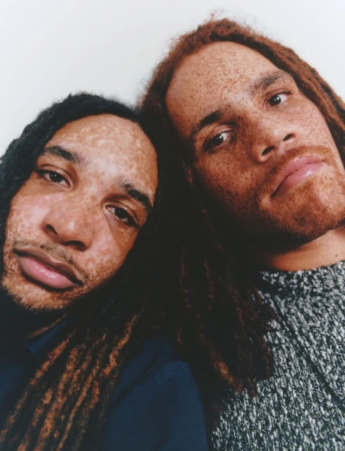 Close-up portrait of two adult men with dreadlocks, fair skin, and freckles, posing closely together against a light neutral background.