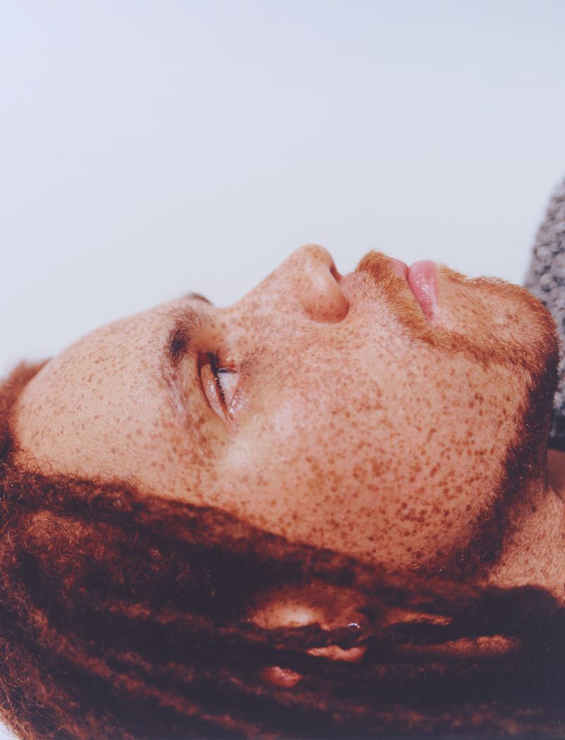 Close-up portrait of adult male with freckles and dreadlocks in a light setting, shot from a low angle, focusing on skin details.