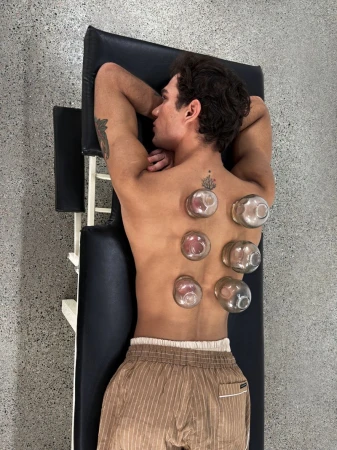 Shirtless man lying face down on a treatment table with glass cupping therapy jars on his back for GQ China wellness project.