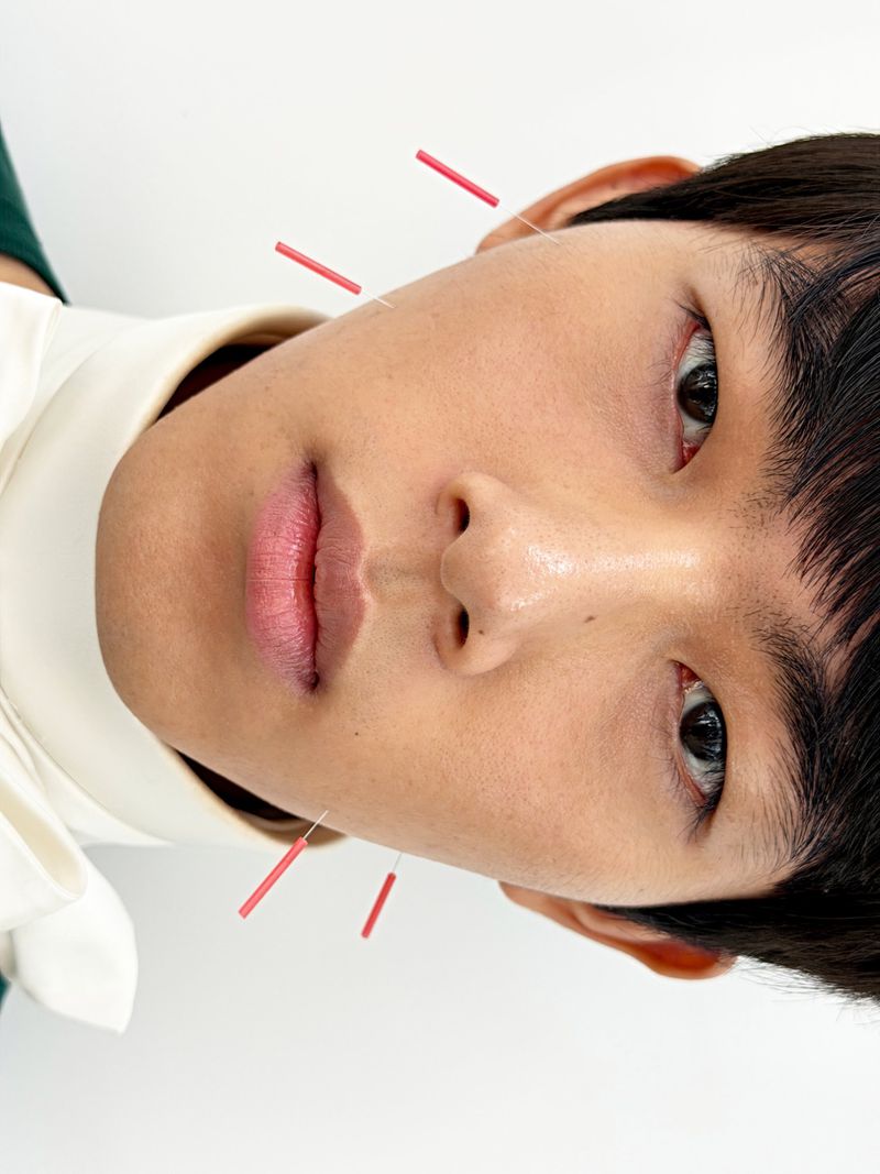 Close-up portrait of a man with acupuncture needles in his face against a white seamless background for GQ China.